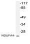 NADH dehydrogenase [ubiquinone] 1 alpha subcomplex subunit 4 antibody, AP20126PU-N, Origene, Western Blot image 