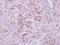 Nicotinate Phosphoribosyltransferase antibody, GTX121545, GeneTex, Immunohistochemistry paraffin image 