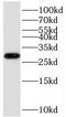 Toll Interacting Protein antibody, FNab10220, FineTest, Western Blot image 
