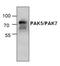 Serine/threonine-protein kinase PAK 7 antibody, GTX59829, GeneTex, Western Blot image 