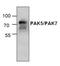 P21 (RAC1) Activated Kinase 5 antibody, GTX59829, GeneTex, Western Blot image 