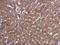 P21 (RAC1) Activated Kinase 4 antibody, GTX111374, GeneTex, Immunohistochemistry paraffin image 