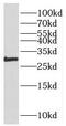 Poly(ADP-Ribose) Polymerase Family Member 11 antibody, FNab06154, FineTest, Western Blot image 