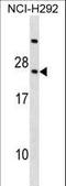 Phospholipase A And Acyltransferase 4 antibody, LS-C158803, Lifespan Biosciences, Western Blot image 