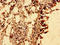 SS-A antibody, LS-C669641, Lifespan Biosciences, Immunohistochemistry paraffin image 