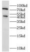 Interleukin-5 receptor subunit alpha antibody, FNab04280, FineTest, Western Blot image 