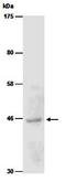 Protein Arginine Methyltransferase 8 antibody, orb66696, Biorbyt, Western Blot image 