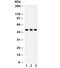 Solute Carrier Family 2 Member 2 antibody, R31942, NSJ Bioreagents, Western Blot image 