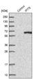 Interferon Induced Protein With Tetratricopeptide Repeats 5 antibody, NBP1-87132, Novus Biologicals, Western Blot image 