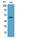 Eukaryotic Translation Elongation Factor 1 Alpha 1 antibody, A02141, Boster Biological Technology, Western Blot image 