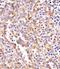 Protein Phosphatase 2 Scaffold Subunit Abeta antibody, M05756, Boster Biological Technology, Immunohistochemistry paraffin image 
