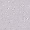 CD25 antibody, HPA054622, Atlas Antibodies, Immunohistochemistry frozen image 