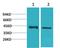 Calcium homeostasis modulator protein 1 antibody, STJ97413, St John