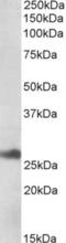 DnaJ Heat Shock Protein Family (Hsp40) Member B9 antibody, NBP1-78785, Novus Biologicals, Western Blot image 