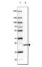 Serine Peptidase Inhibitor, Kazal Type 13 (Putative) antibody, NBP1-93701, Novus Biologicals, Western Blot image 