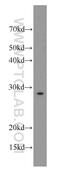 Sodium Voltage-Gated Channel Beta Subunit 4 antibody, 55438-1-AP, Proteintech Group, Western Blot image 