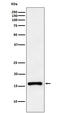 Cyclin Dependent Kinase Inhibitor 2C antibody, M03299-1, Boster Biological Technology, Western Blot image 