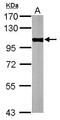 Glycogen Phosphorylase, Muscle Associated antibody, GTX110411, GeneTex, Western Blot image 