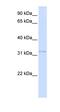 Voltage Dependent Anion Channel 2 antibody, orb329811, Biorbyt, Western Blot image 