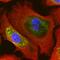 Keratin 14 antibody, MAB3164, R&D Systems, Immunocytochemistry image 