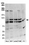 ATPase Sarcoplasmic/Endoplasmic Reticulum Ca2+ Transporting 2 antibody, GTX23625, GeneTex, Western Blot image 