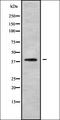 Programmed Cell Death 2 antibody, orb337824, Biorbyt, Western Blot image 