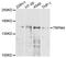 Transient receptor potential cation channel subfamily M member 4 antibody, STJ112185, St John