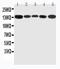 Regulator Of G Protein Signaling 3 antibody, PA2050, Boster Biological Technology, Western Blot image 