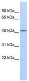 Epithelial Stromal Interaction 1 antibody, TA346651, Origene, Western Blot image 