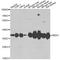Malate Dehydrogenase 1 antibody, STJ29701, St John