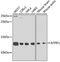 ATP Synthase Inhibitory Factor Subunit 1 antibody, GTX33029, GeneTex, Western Blot image 