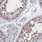 Coiled-Coil Domain Containing 97 antibody, NBP1-91767, Novus Biologicals, Immunohistochemistry frozen image 