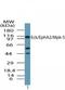 EPH Receptor A2 antibody, PA5-23144, Invitrogen Antibodies, Western Blot image 