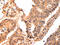 Calpain Small Subunit 1 antibody, CSB-PA921513, Cusabio, Immunohistochemistry paraffin image 