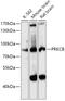 Protein Kinase C Beta antibody, 19-895, ProSci, Western Blot image 