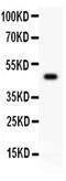 Sialophorin antibody, PA5-80067, Invitrogen Antibodies, Western Blot image 