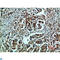 Heat Shock Protein Family A (Hsp70) Member 5 antibody, LS-C813869, Lifespan Biosciences, Immunohistochemistry paraffin image 