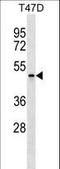 Apolipoprotein B MRNA Editing Enzyme Catalytic Polypeptide Like 4 antibody, LS-C159096, Lifespan Biosciences, Western Blot image 