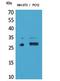 TNF Receptor Superfamily Member 10c antibody, STJ96848, St John