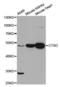 Cathepsin D antibody, A1594, ABclonal Technology, Western Blot image 