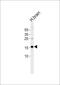 Microtubule Associated Protein 1 Light Chain 3 Alpha antibody, PA5-72203, Invitrogen Antibodies, Western Blot image 