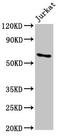 Insulin Like Growth Factor 2 MRNA Binding Protein 1 antibody, LS-C673684, Lifespan Biosciences, Western Blot image 