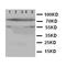 Arachidonate 5-Lipoxygenase antibody, LS-C312799, Lifespan Biosciences, Western Blot image 