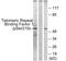 Telomeric Repeat Binding Factor 1 antibody, PA5-38925, Invitrogen Antibodies, Western Blot image 