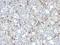 Carbamoyl-Phosphate Synthase 1 antibody, orb388005, Biorbyt, Immunohistochemistry paraffin image 