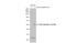 Checkpoint Kinase 1 antibody, GTX100065, GeneTex, Western Blot image 