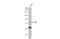 Receptor Interacting Serine/Threonine Kinase 1 antibody, GTX111235, GeneTex, Western Blot image 