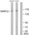 SWI/SNF Related, Matrix Associated, Actin Dependent Regulator Of Chromatin Subfamily C Member 2 antibody, GTX87201, GeneTex, Western Blot image 