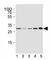 Cyclin Dependent Kinase 5 antibody, F52480-0.4ML, NSJ Bioreagents, Western Blot image 