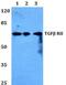 Transforming Growth Factor Beta Receptor 2 antibody, LS-B12168, Lifespan Biosciences, Western Blot image 